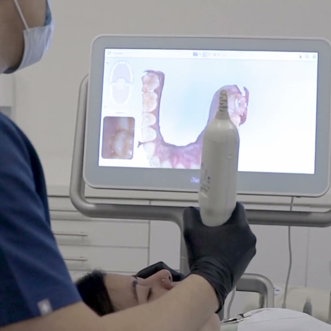 Especialista usando el escáner intraoral con la imagen en pantalla