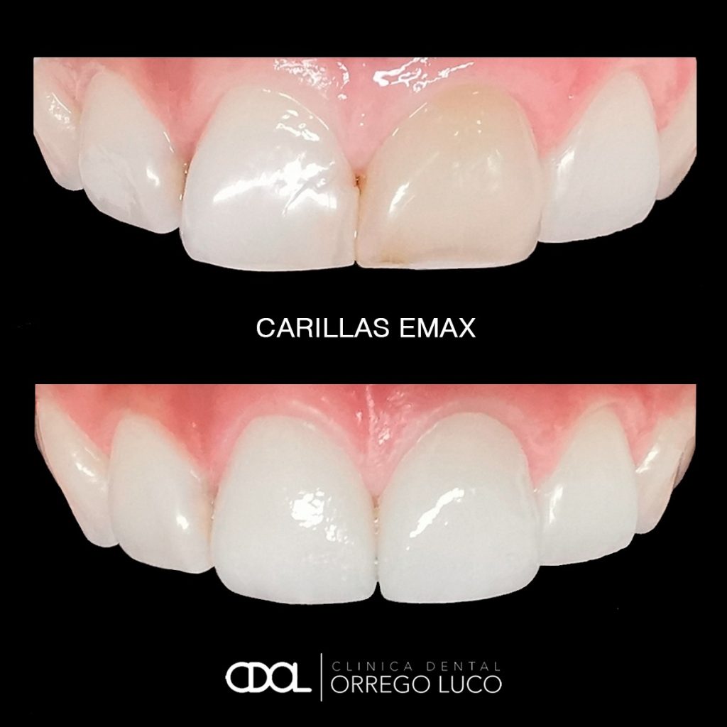 Clinica Orrego Luco