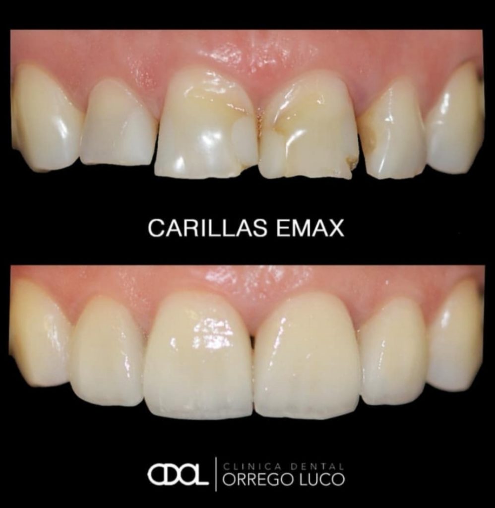 Clinica Orrego Luco