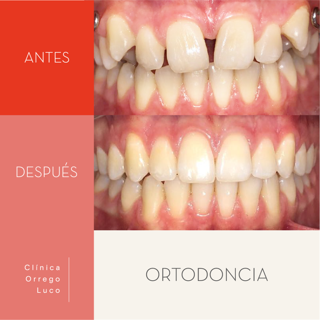 Clinica Orrego Luco