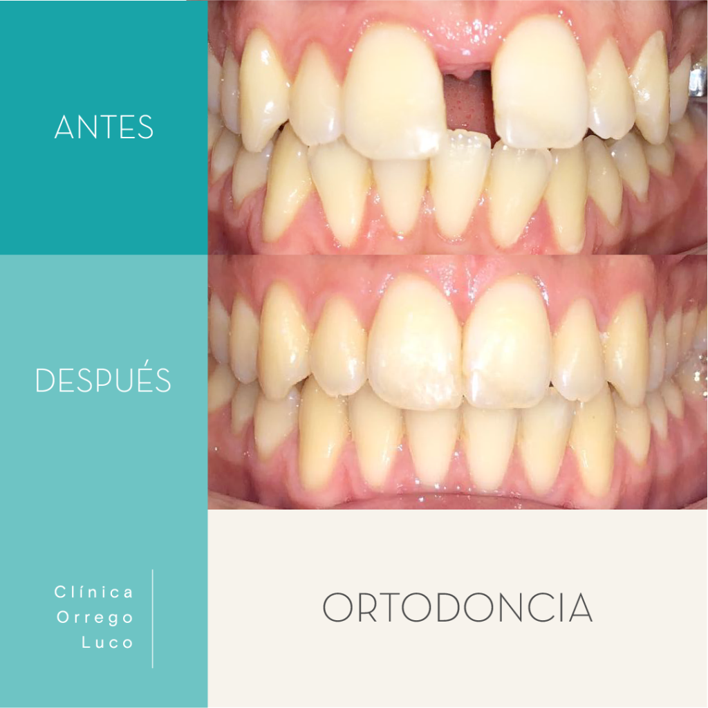 Clinica Orrego Luco