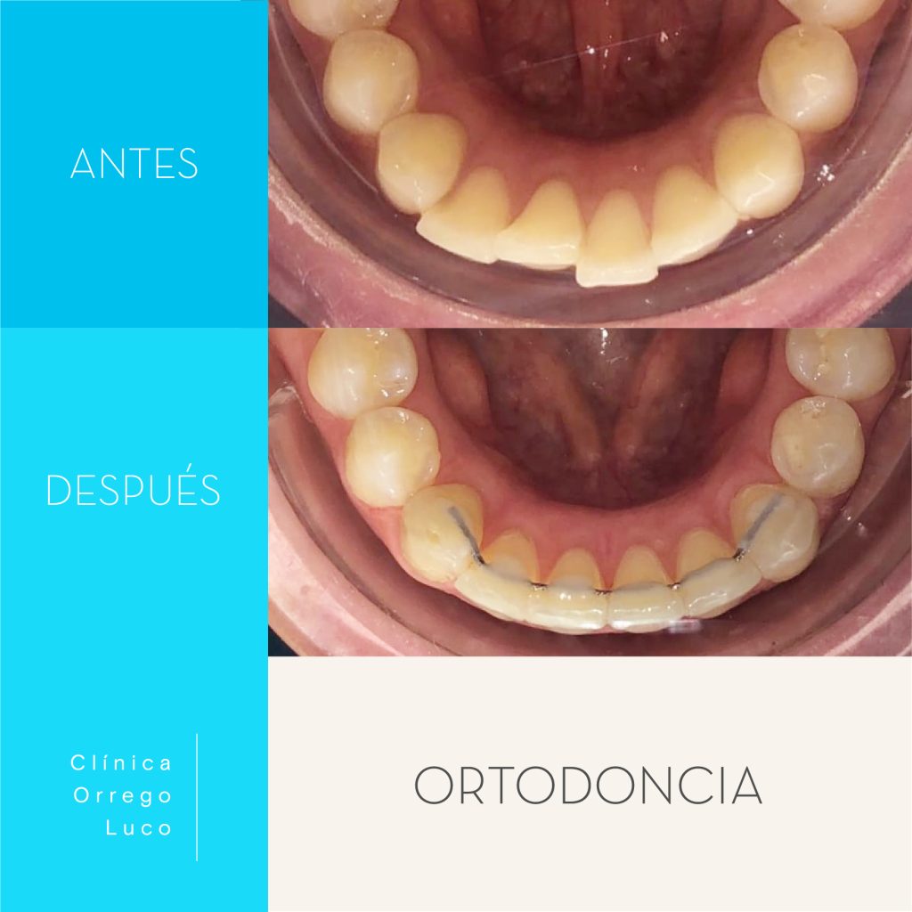 Clinica Orrego Luco