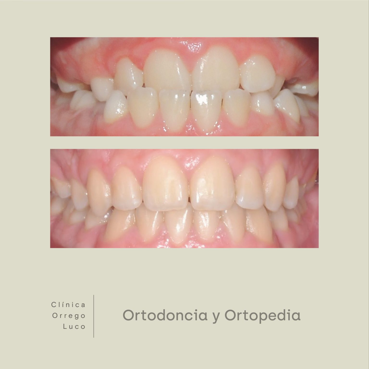 clinica orrego luco - ortodoncia y ortopedia