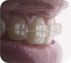 clinica orrego luco - ortodoncia