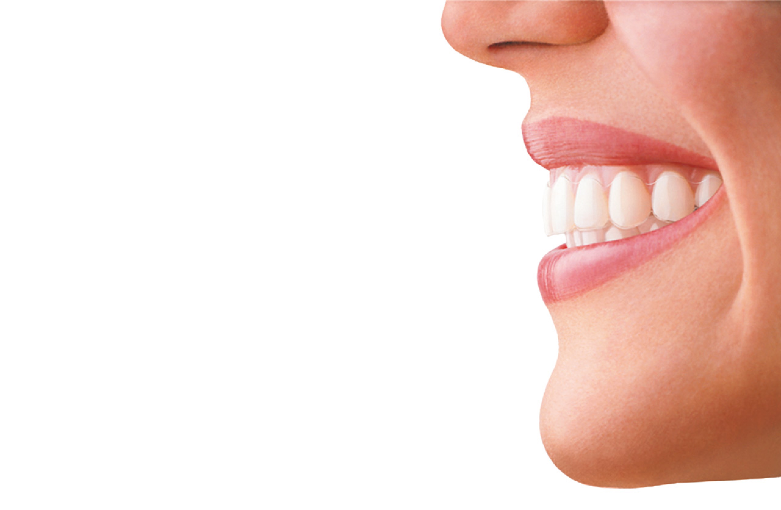 clinica orrego luco - alineadores